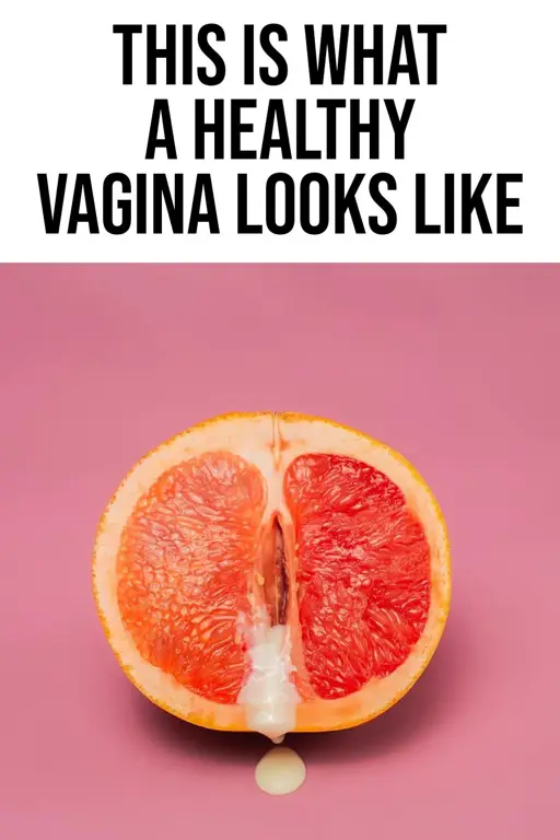 Vulva yang sehat