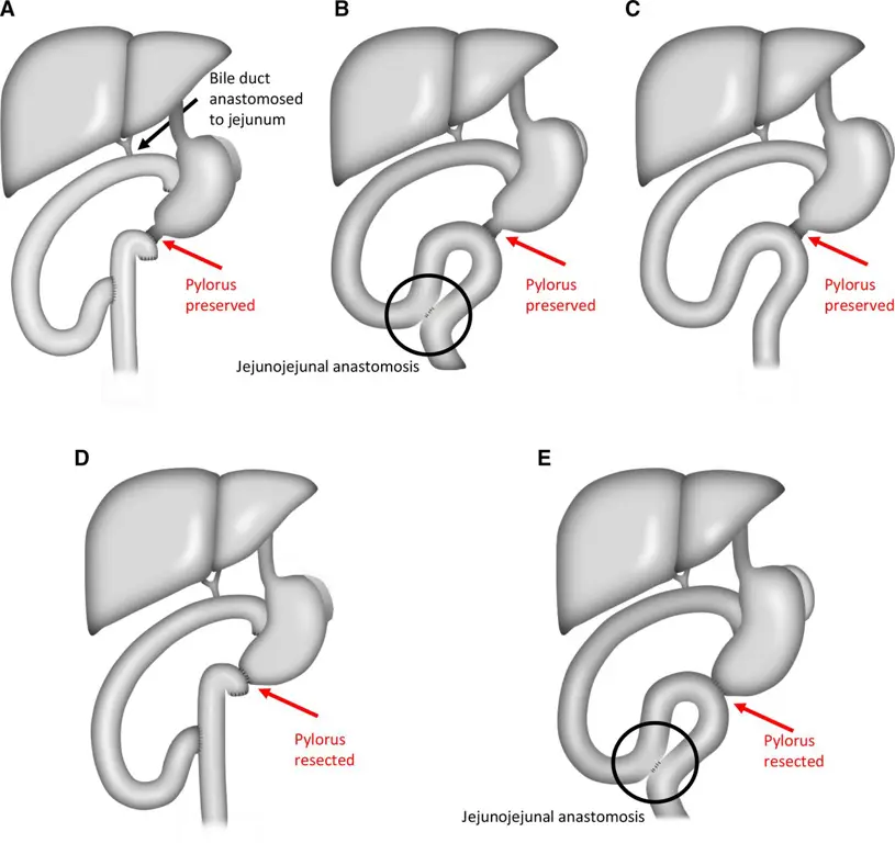 Diagram yang menjelaskan detail PPPd 282