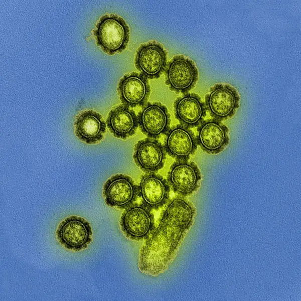 Gambar virus di bawah mikroskop