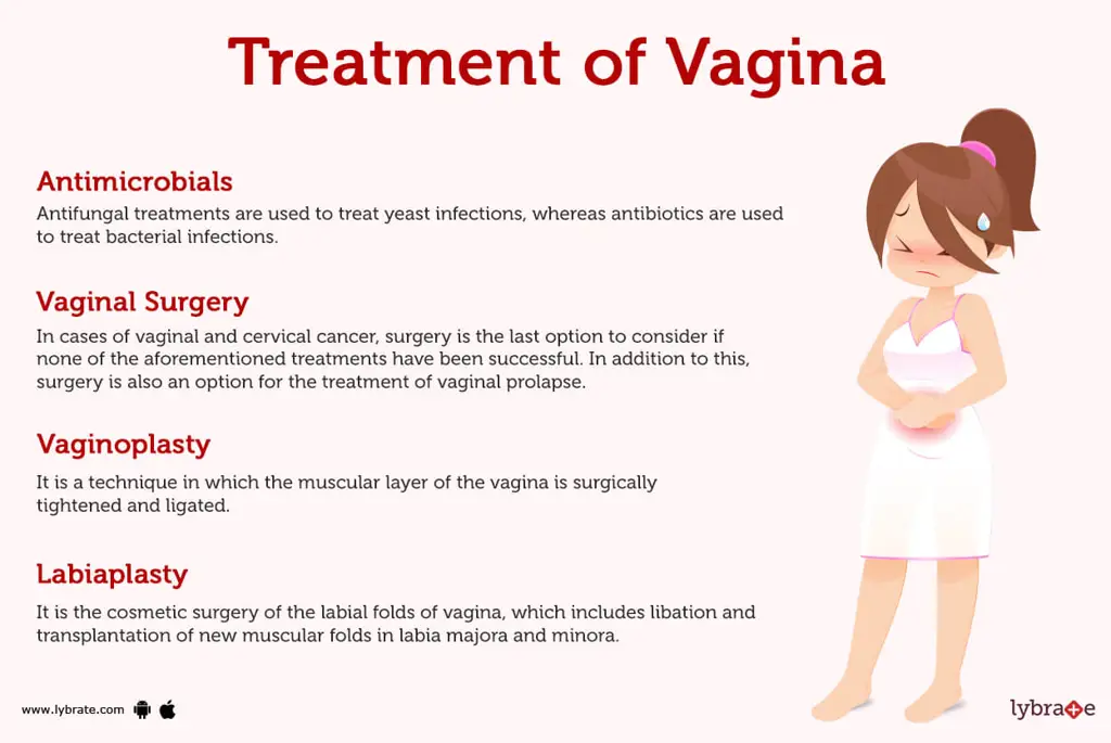 Ilustrasi vagina sehat