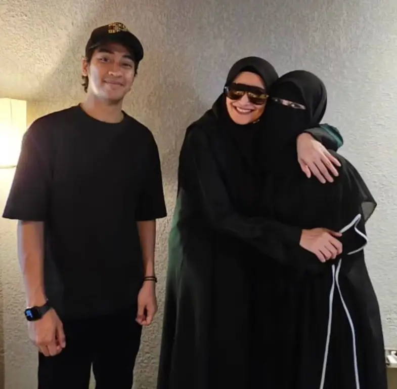 Foto Umi Pipik sebelum berhijab