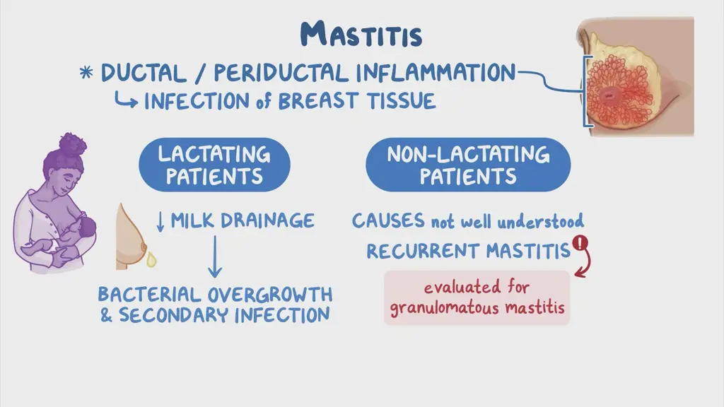 Ilustrasi pengobatan mastitis pada ibu menyusui