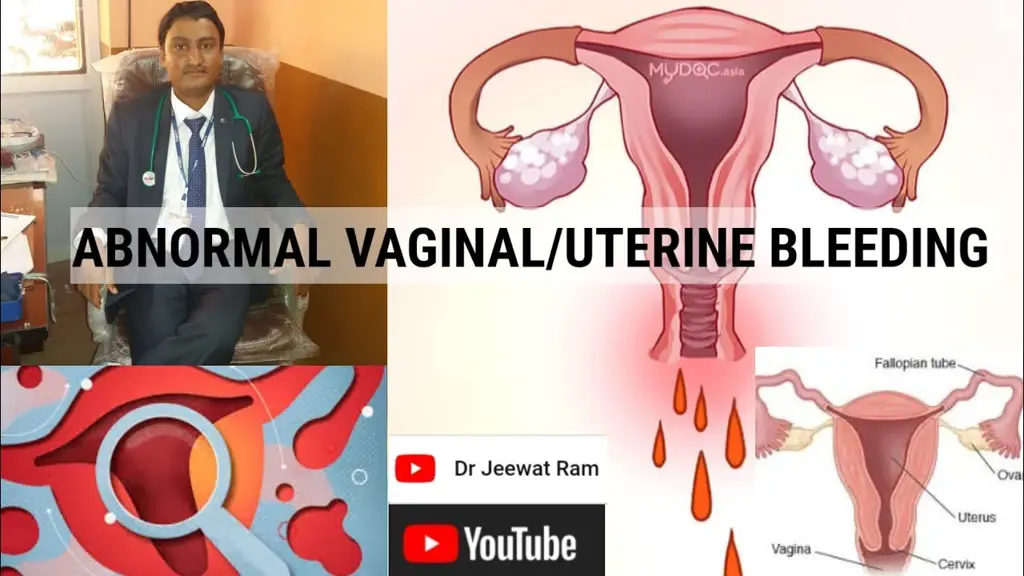 Ilustrasi berbagai penyebab pendarahan vagina