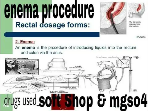 Gambar ilustrasi prosedur medis enema.