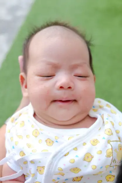 Gambar wajah bayi dengan ruam dari dekat