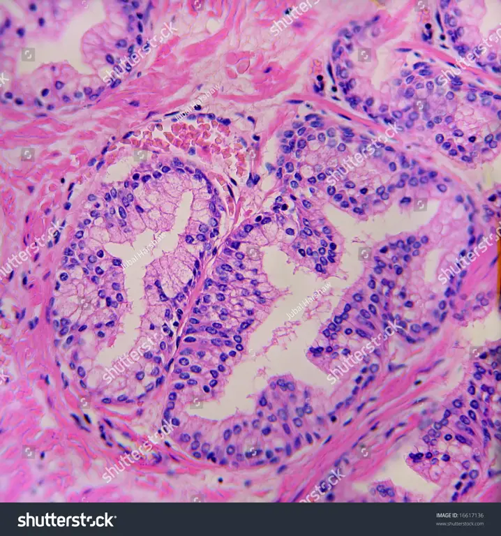 Gambar mikroskopis kelenjar prostat