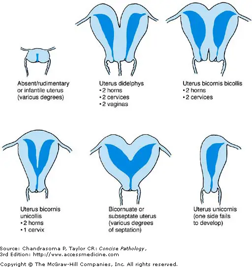 Gambar vulva wanita dengan bulu kemaluan