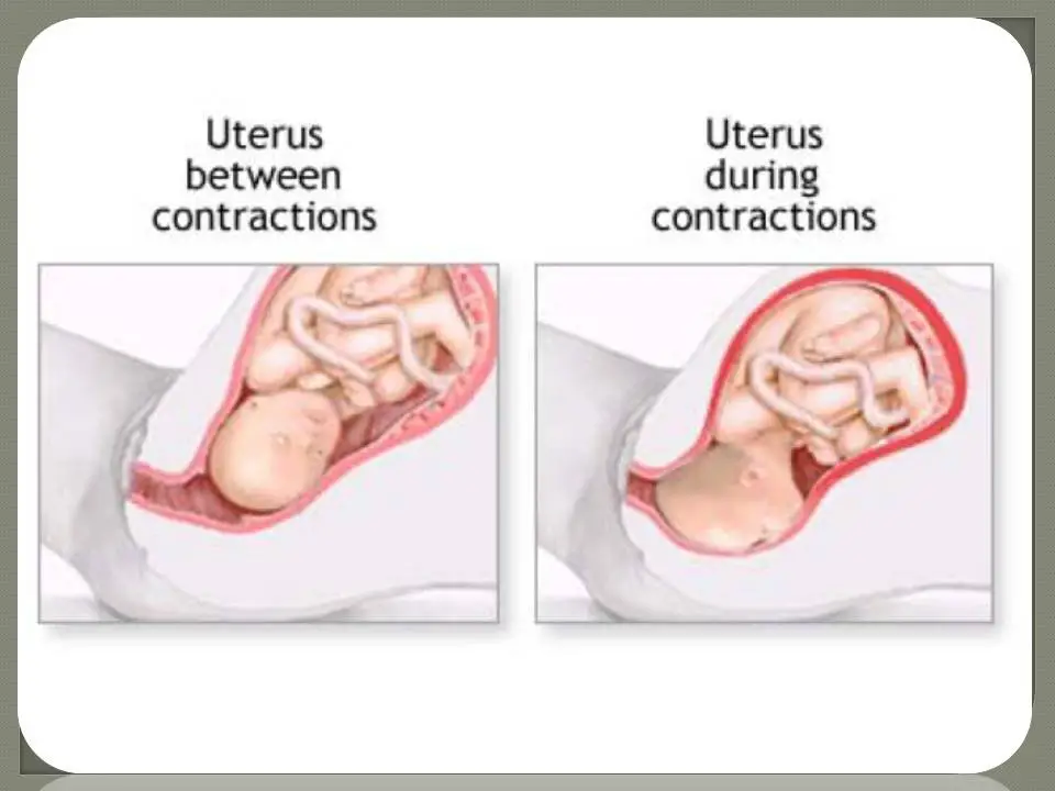 Wanita hamil mengalami kontraksi